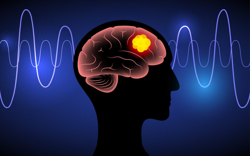 A Smarter Way to Target Brain Cancer
