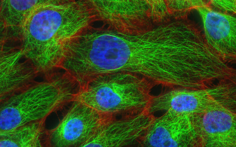Why Breast Cancer Is Harder to Treat Than We Thought
