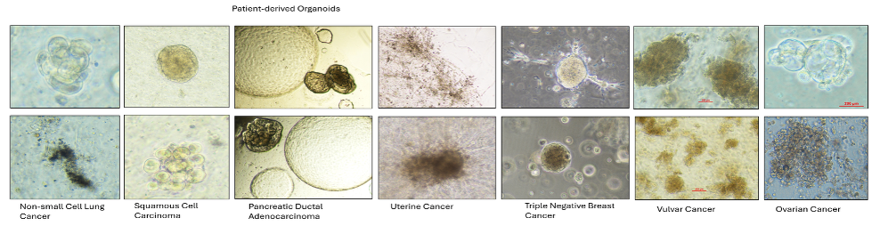 Patient-derived organoids