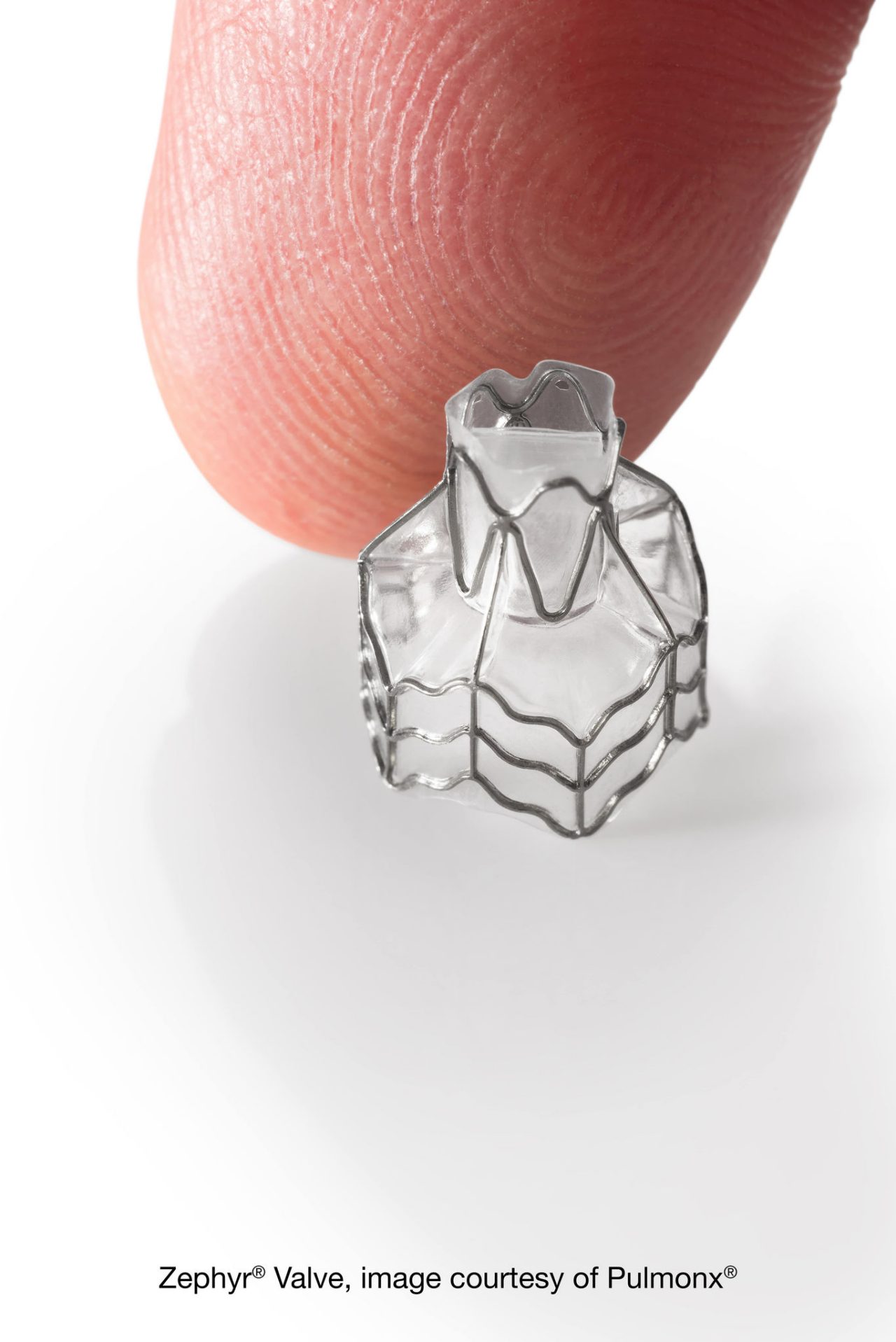 Pulmonx Zephyr Valve Size