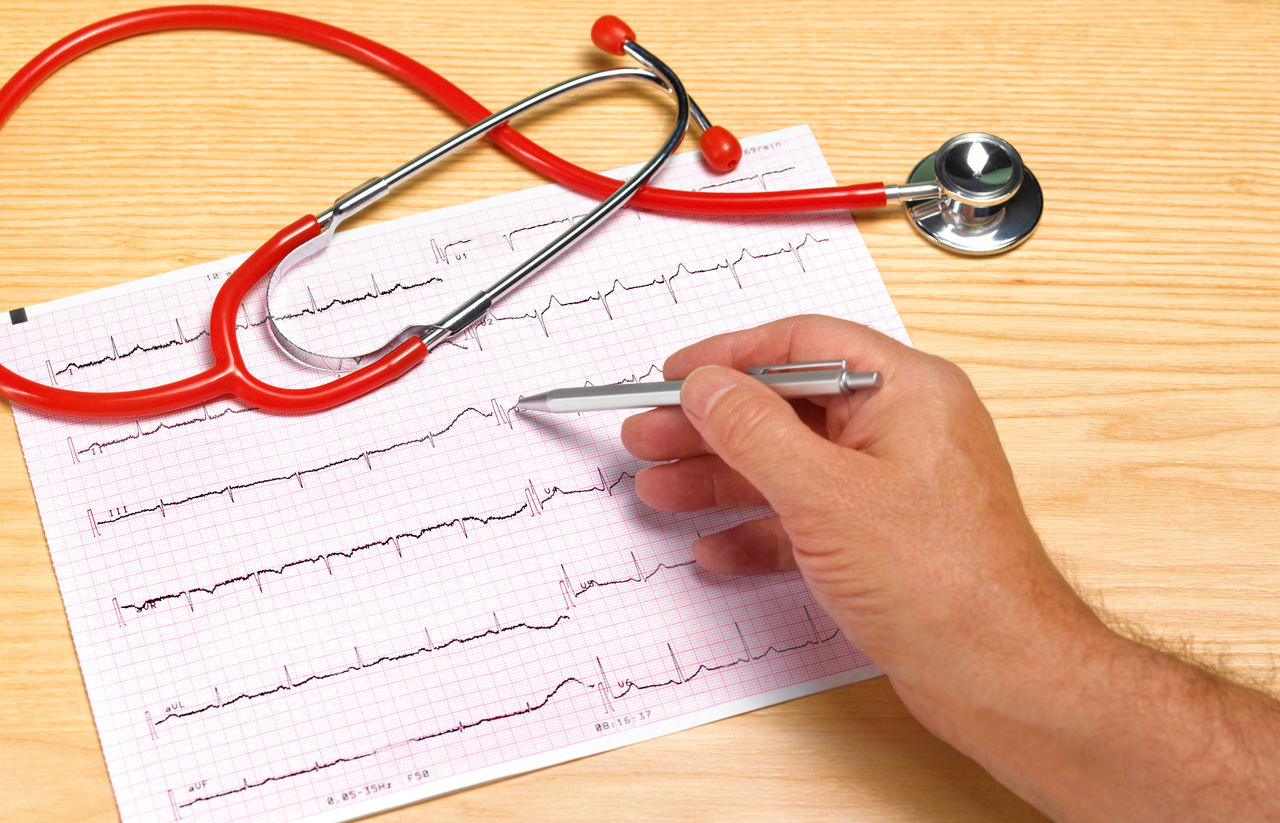 Doctor with a stethoscope and EKG printout